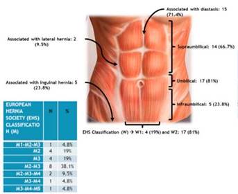 Giant inguinal hernia repair using standard transverse inguinal incision  with mesh. A retrospective case control study, BMC Surgery