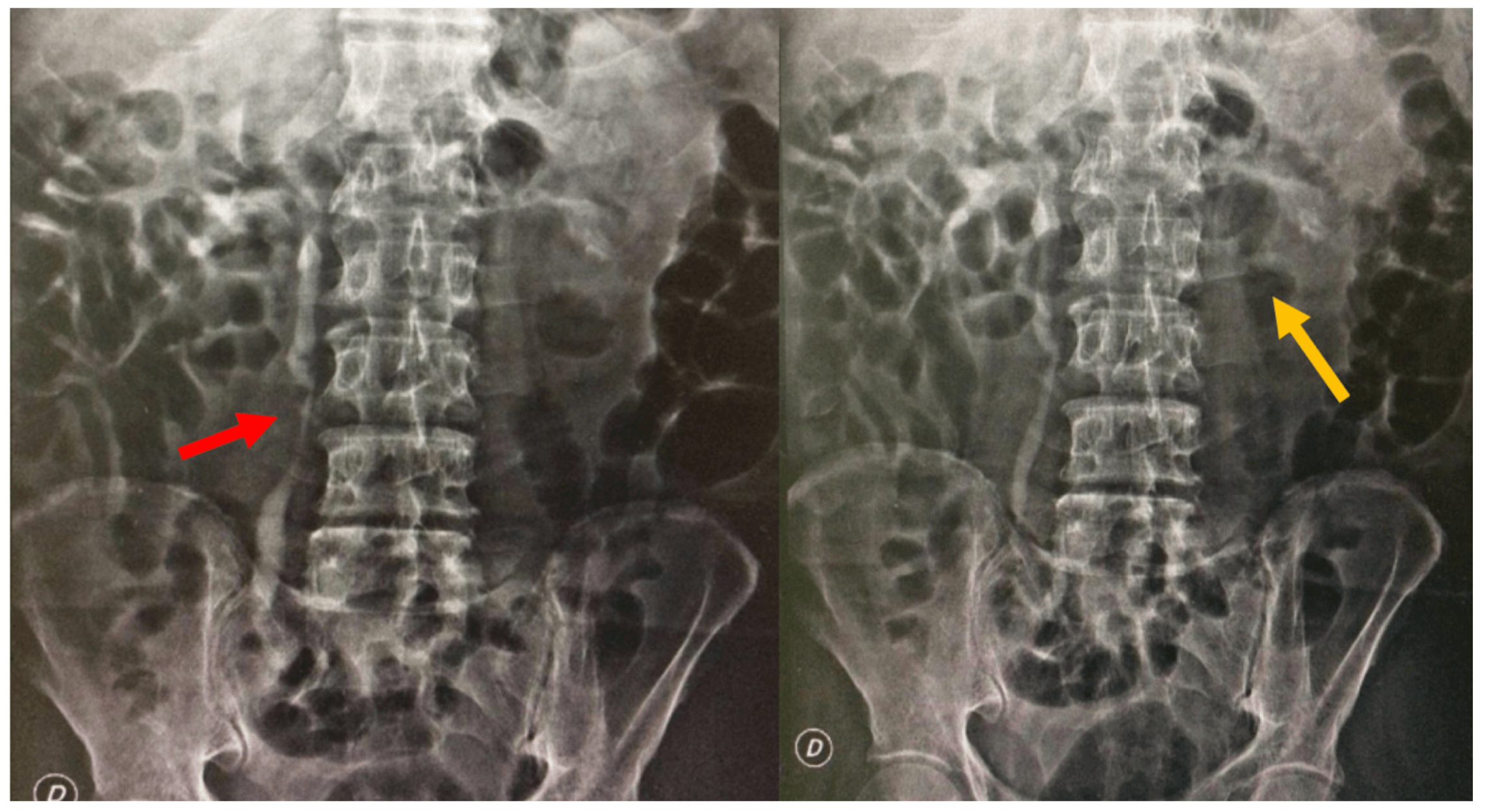 A picture containing X-ray film

Description automatically generated